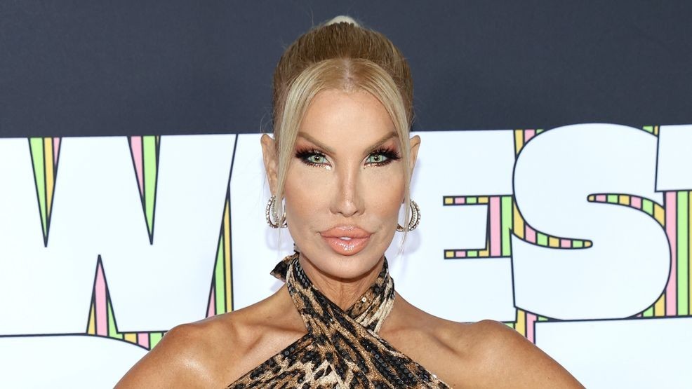 Image for story: '90 Day Fiancé' star is home after a 'complicated surgery' caused 'excessive bleeding'