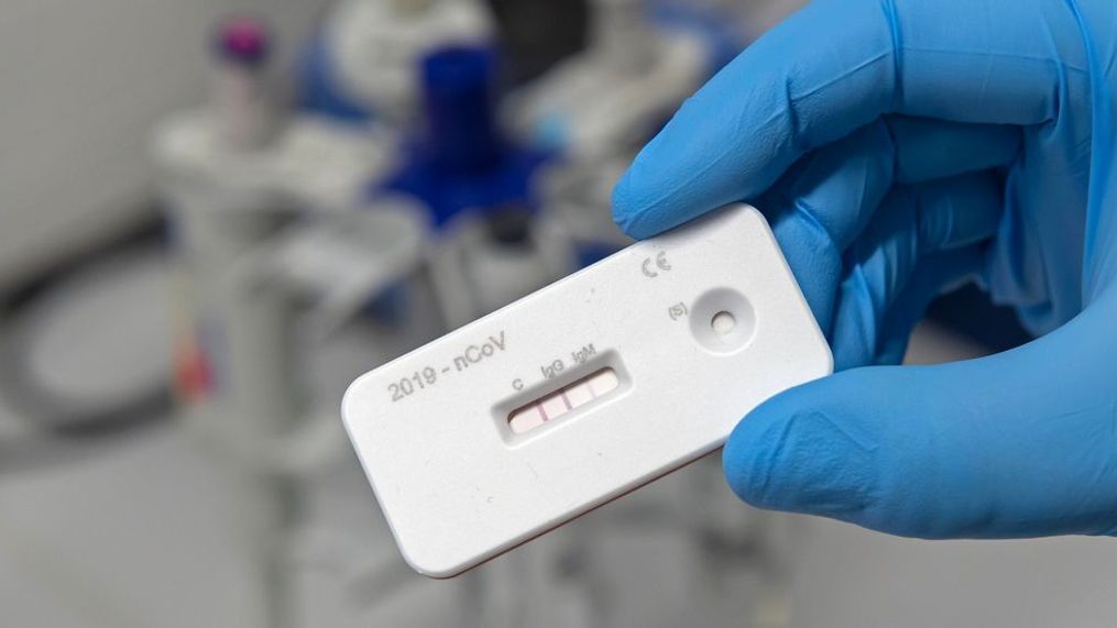 A scientist presents an antibody test for coronavirus in a laboratory of the Leibniz Institute of Photonic Technology (Leibniz IPHT) at the InfectoGnostics research campus in Jena, Germany, Friday, April 3, 2020. (AP Photo/Jens Meyer)