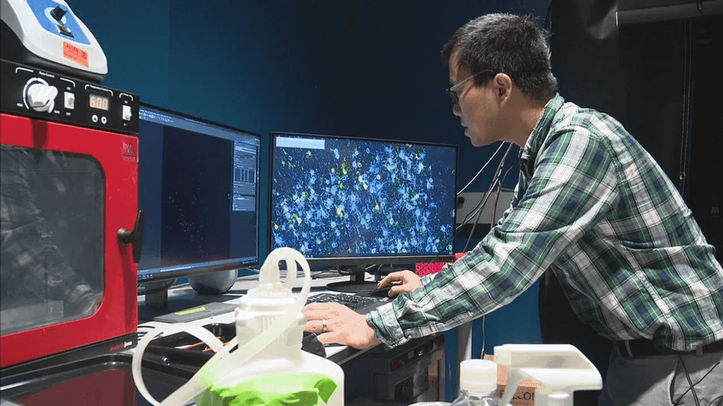 Xiaoyin Chen, assistant investigator at the Allen Institute, shows KOMO News uniquely labelled neurons in the cortex of a brain as part of the institute’s research. (KOMO News)  