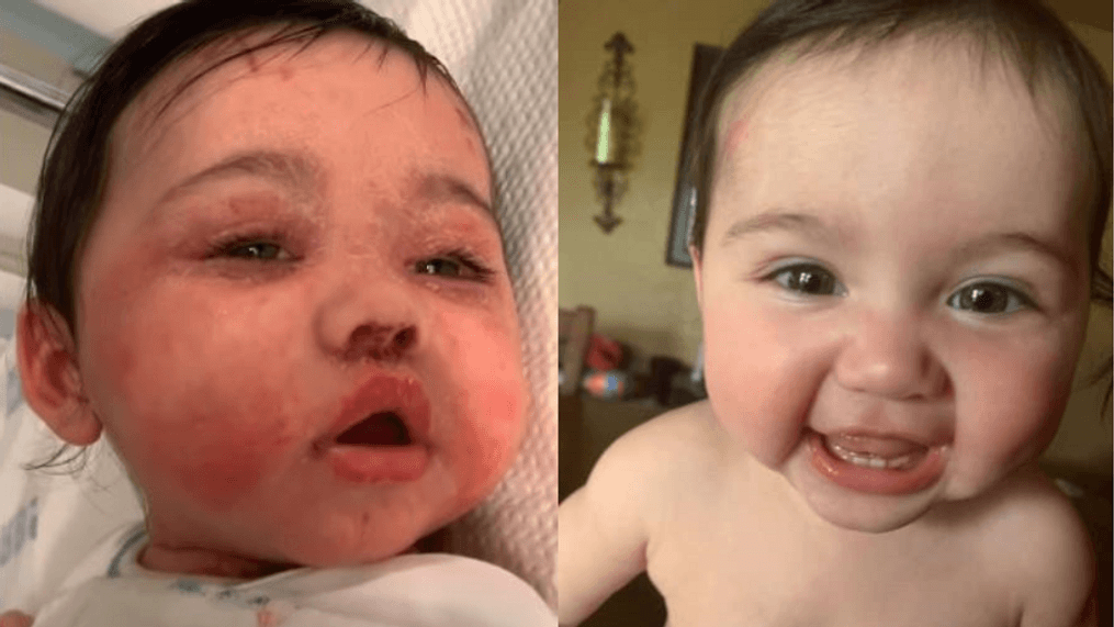 6-month-old Valentina Victoria is doing better as she battles COVID-19. (Photos courtesy Victoria family)