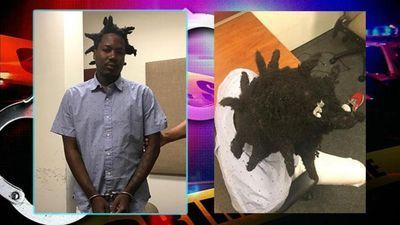 Image for story: Florida man found with cocaine hidden in his hair