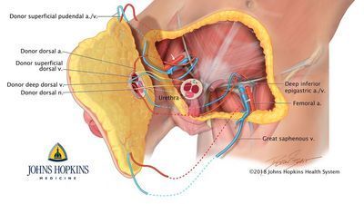 Image for story: Johns Hopkins performs world's first penis, scrotum transplant on wounded soldier