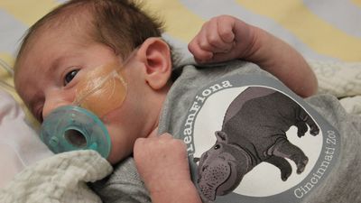 Image for story: Fiona onesies for NICU babies at Cincinnati Children's Hospital