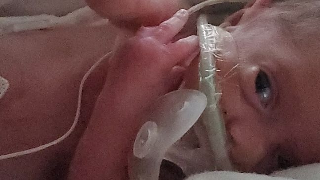 Little Maximus Diaz was born nearly four months premature, and is fighting for his life amid the COVID-19 pandemic. (Courtesy: Diaz Family)