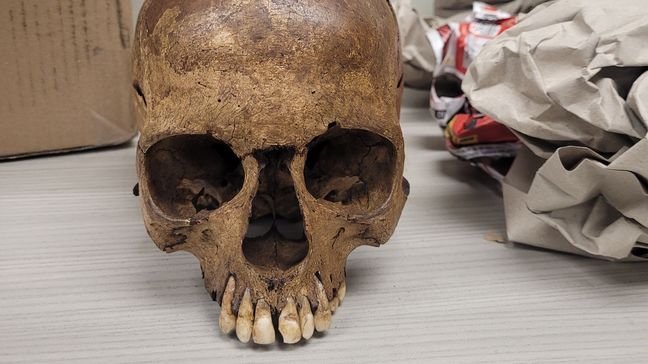 FILE - Human skulls found at Chicago O'Hare Airport heading to Iowa (Photo: U.S. Customs and Border Protection)